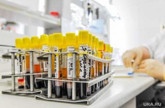 работают ли кафе в хмао