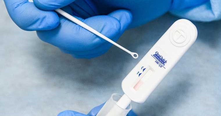 Эпидемия ВИЧ Свердловская область данные