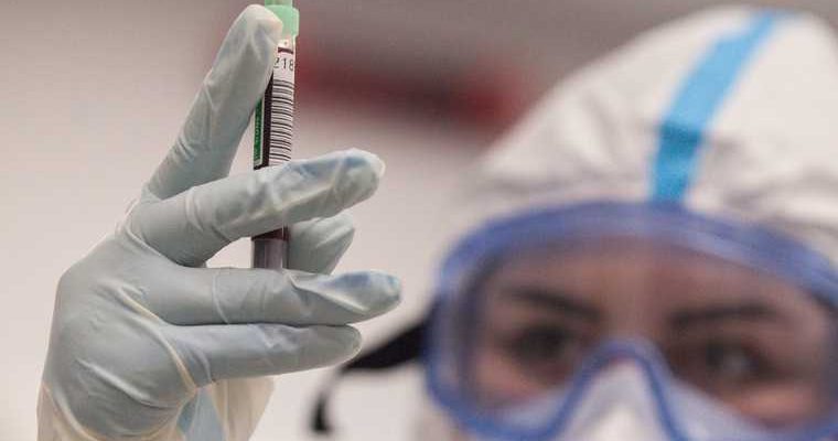 от чего зависит смерть от коронавируса